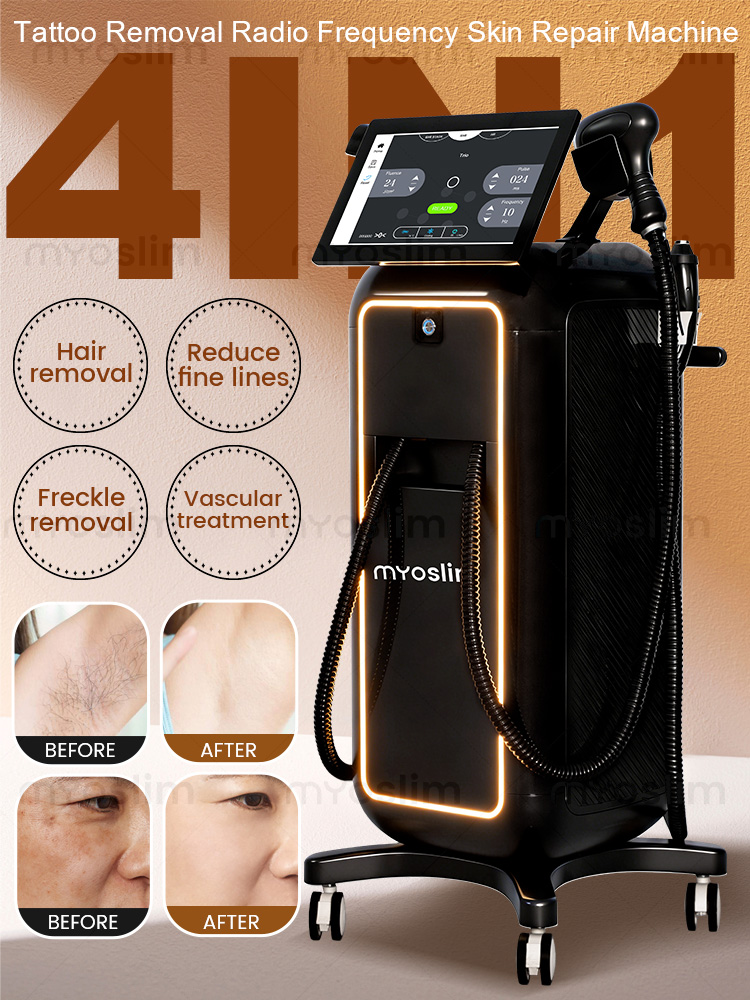 Industrial Laser Hair Removal Machine - 4 IN 1 Soprano Titanium Ice